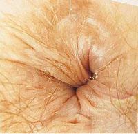 anus.jpg